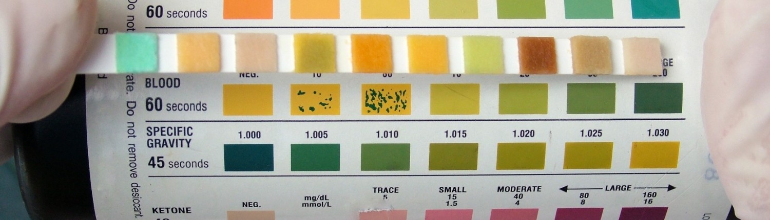 Myth #4: You Can Test Your Urine to Determine Whether You’re Acidic